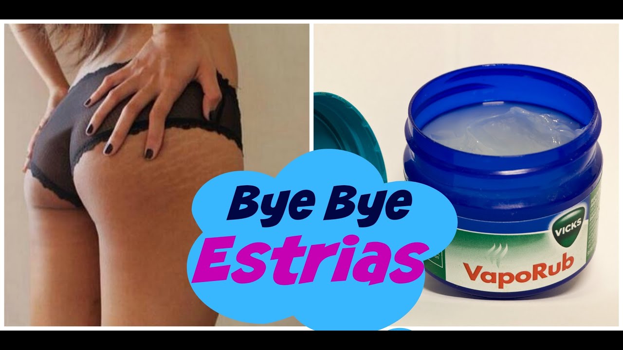 Tratamento Para As Estrias Vick Vaporub