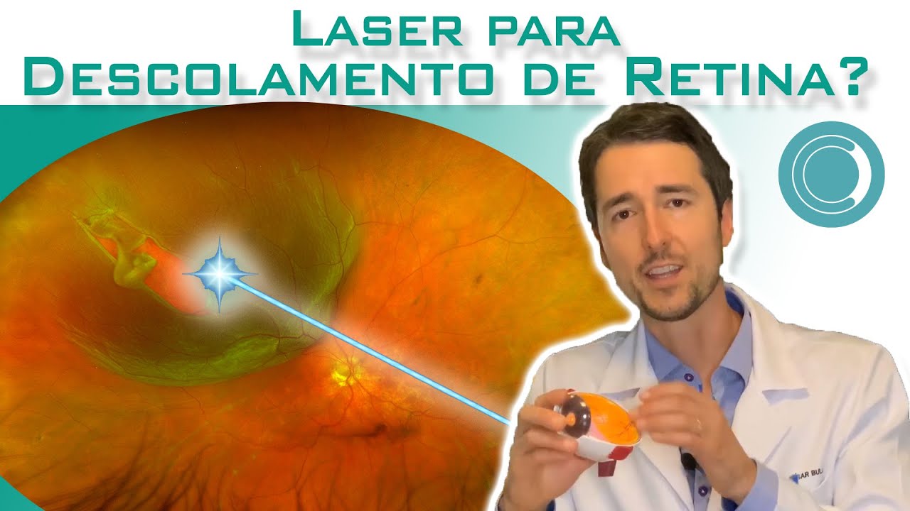 Descolamento De Retina Entenda Como Funciona O Tratamento A Laser