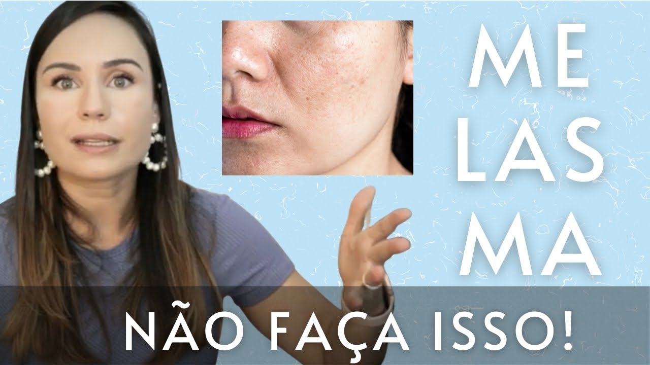 Descubra Como Evitar Erros Comuns No Tratamento Do Melasma