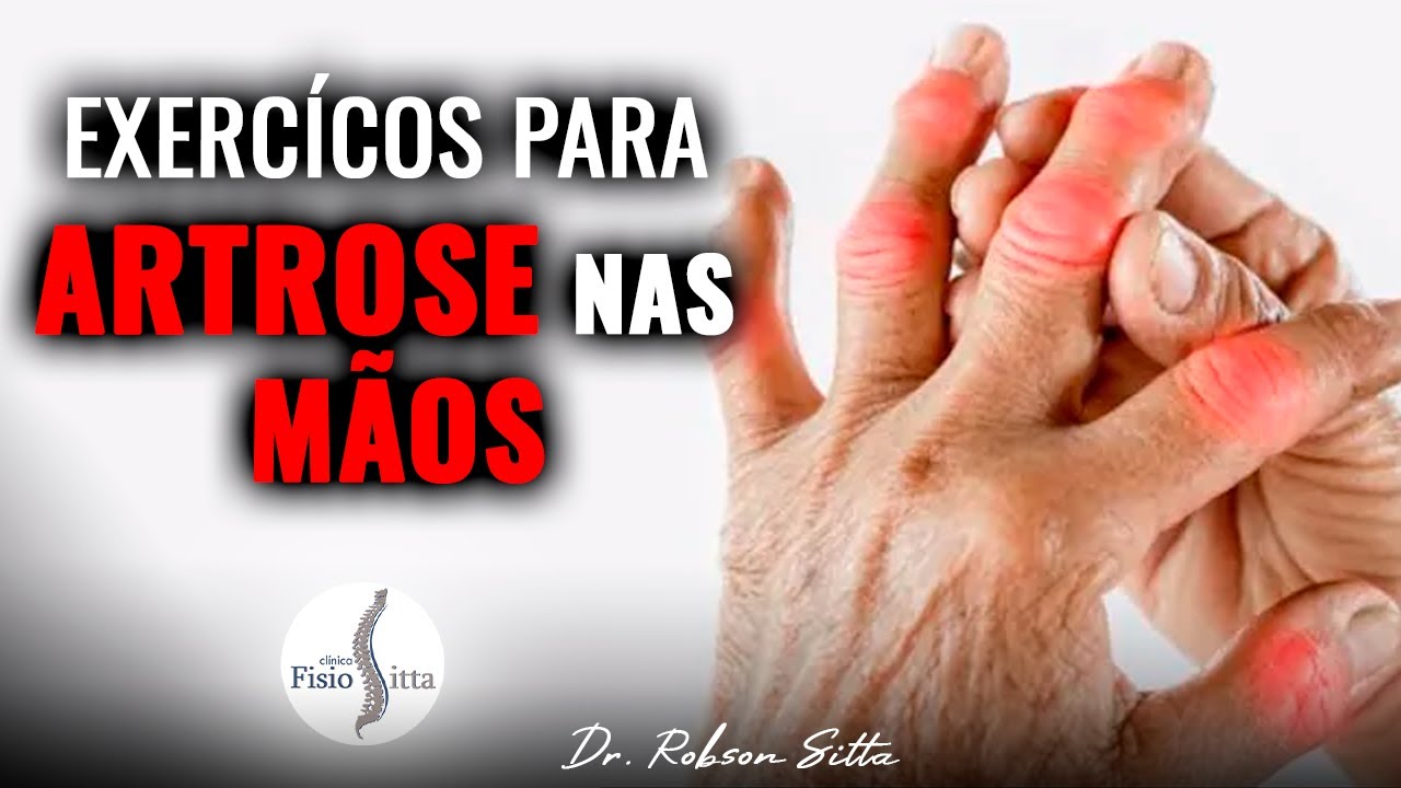 Exercícios de fisioterapia para artrose nos dedos das mãos na Clínica Dr Robson Sitta