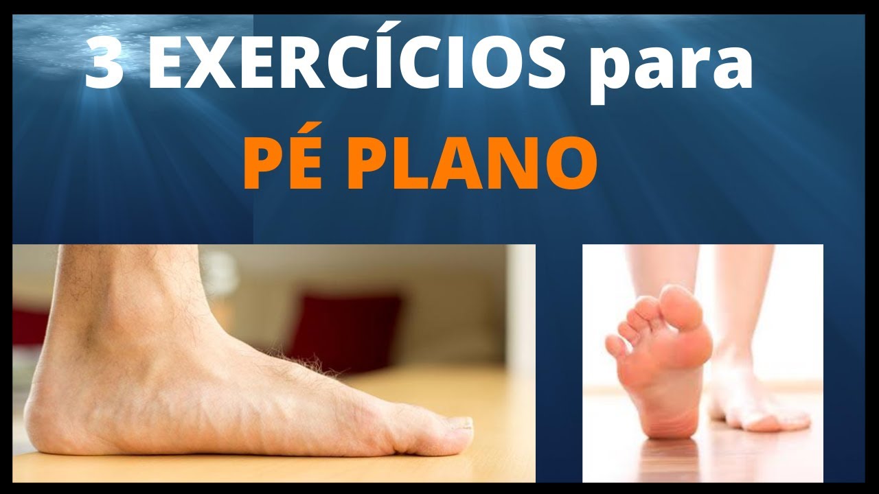 Aprenda 3 exercícios eficazes para melhorar o pé plano