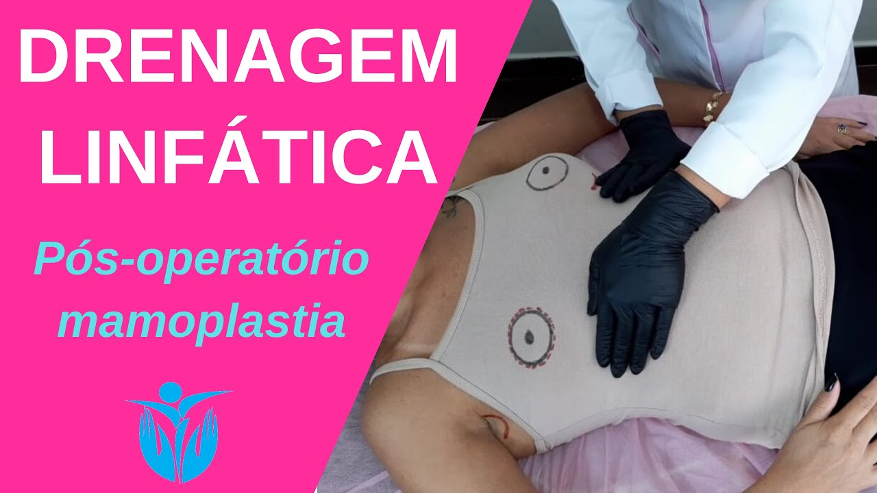 Drenagem linfática no pós operatório de mamoplastia benefícios e cuidados