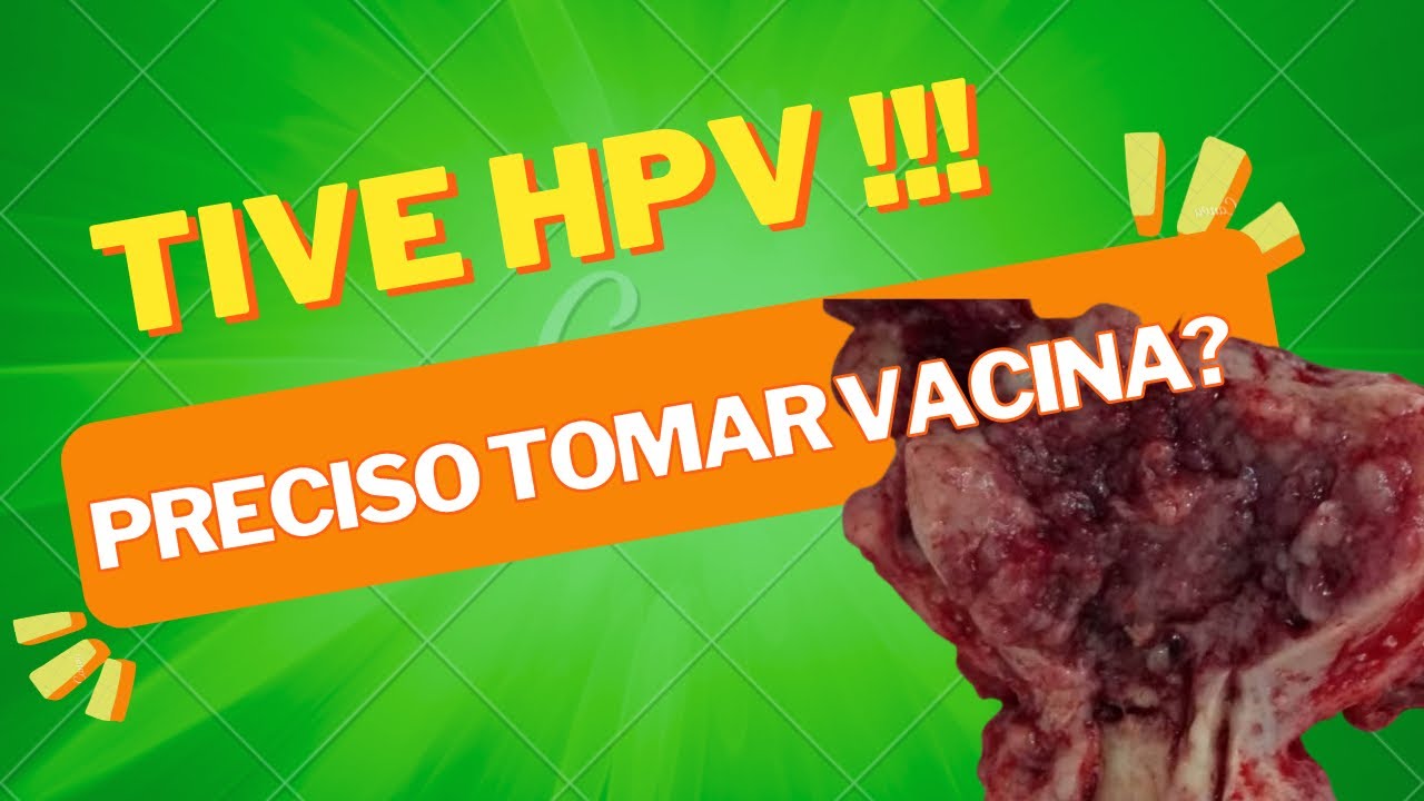 Hpv E C Ncer O Que Voc Precisa Saber Dra Roberta Gomes Hpv