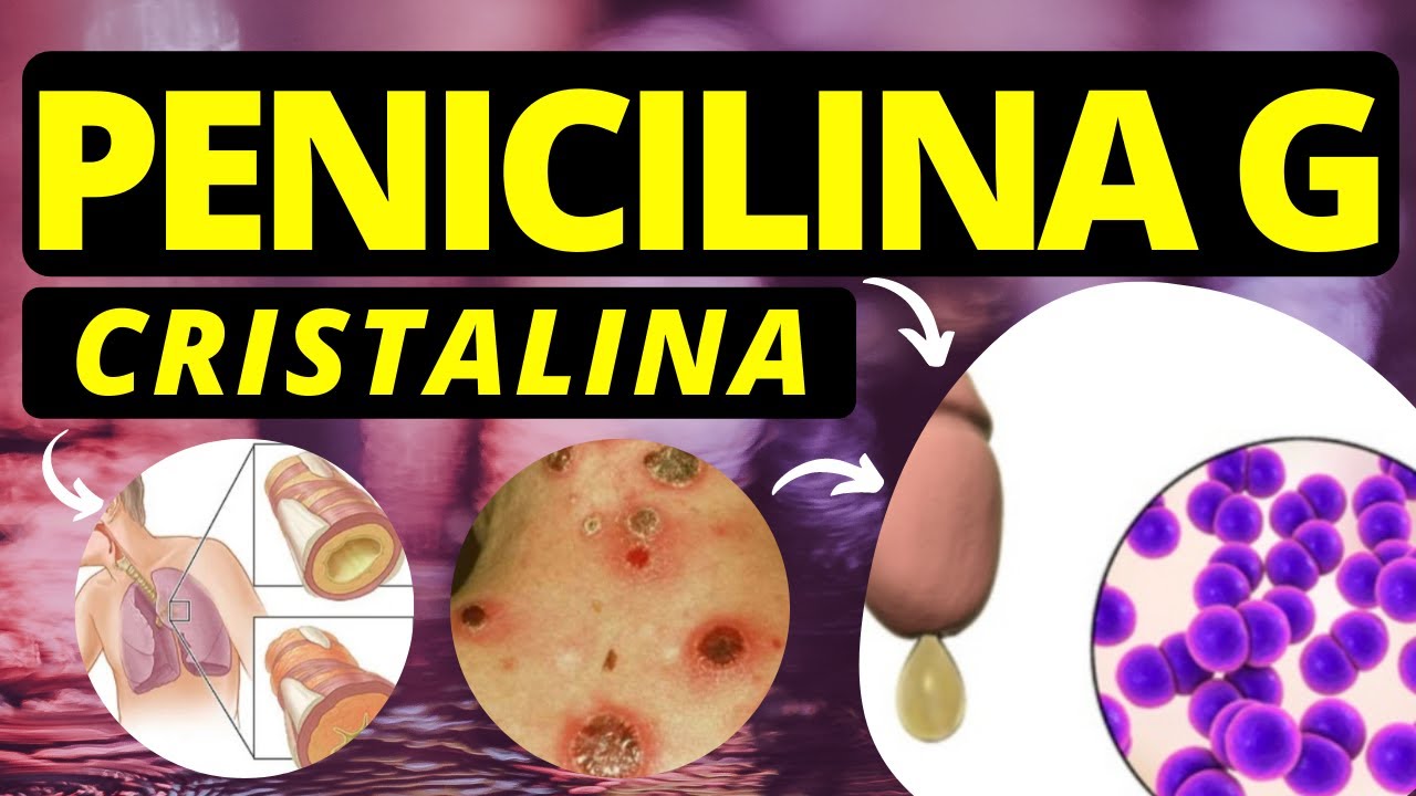 PENICILINA G CRISTALINA: Apresentação, mecanismo, reações, interação e ...