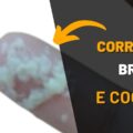 APRENDA: corrimento branco LEITOSO de REPETIÇÃO como TRATAR