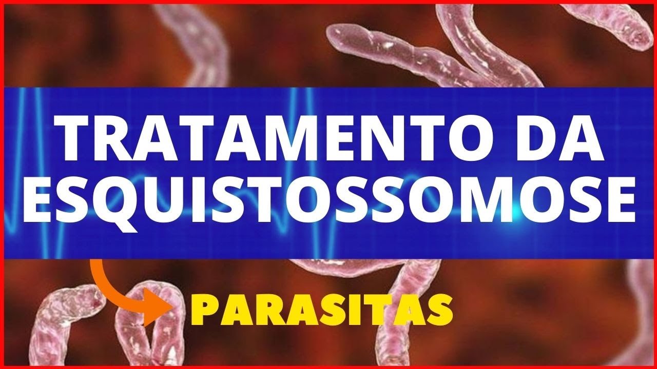 Tratamento Para Esquistossomose Schistosoma Mansoni Parasitologia Infectologia 3516