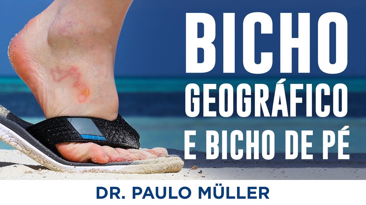 Bicho Geográfico e Bicho de Pé - Dr Paulo Müller Dermatologista