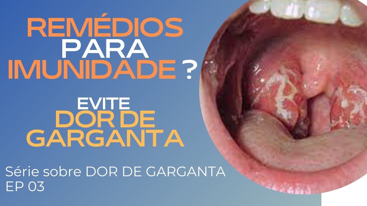 DOR DE GARGANTA: Quais sāo os remédios para melhorar a imunidade e ...