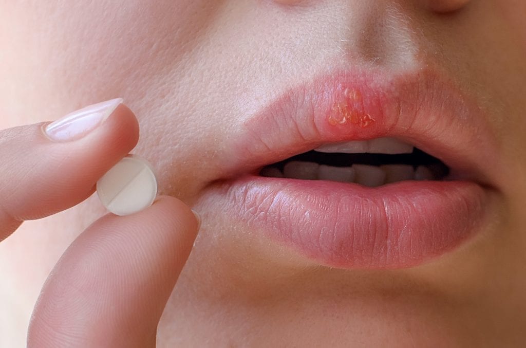 aciclovir comprimido para que serve 