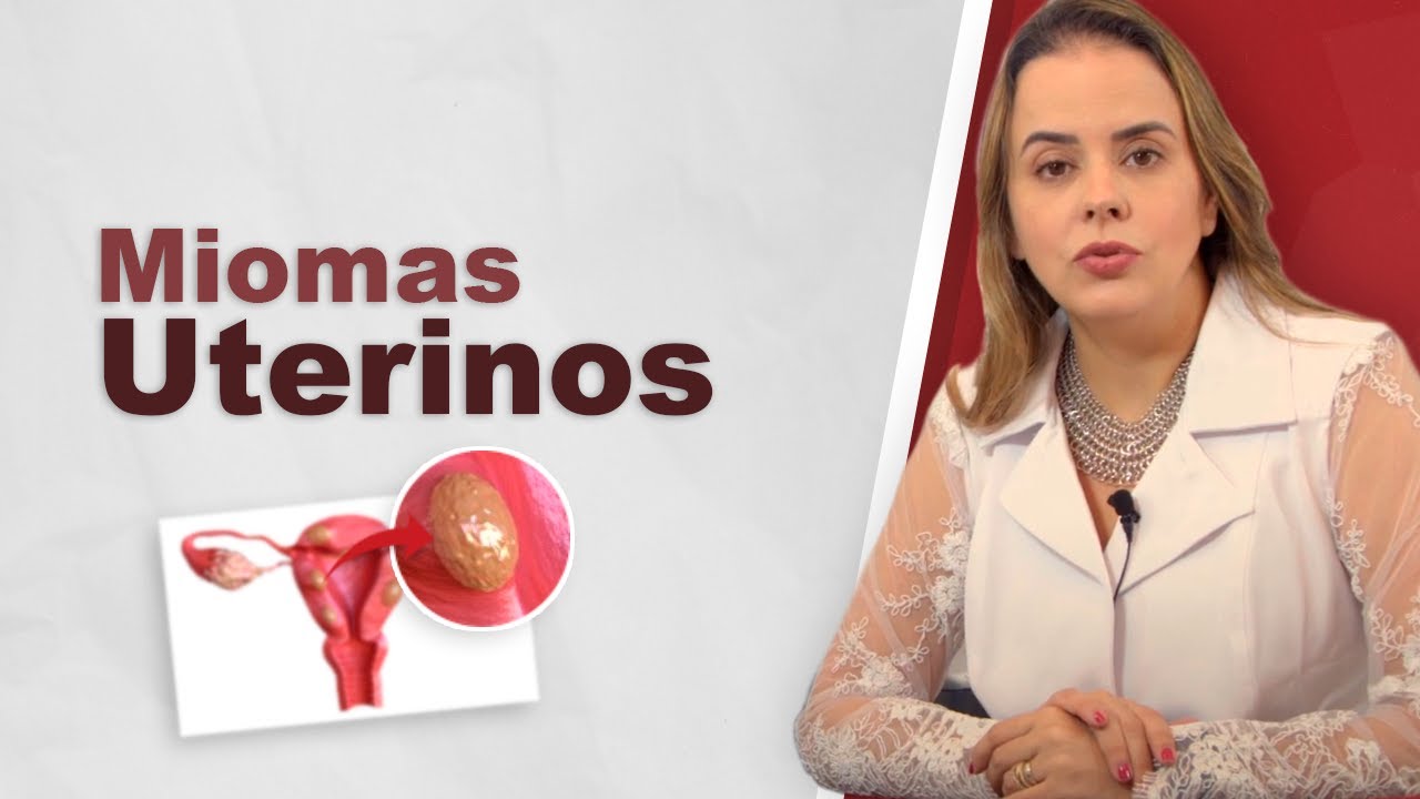 Conheça: Miomas Uterinos