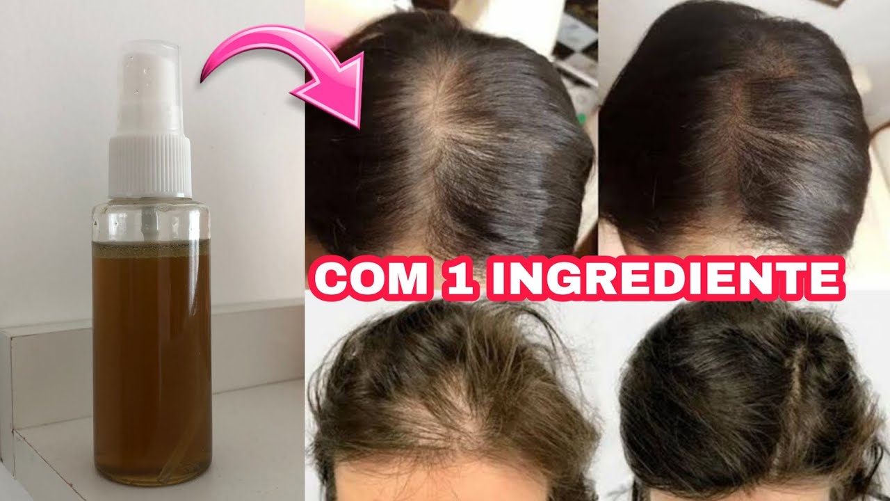 Descubra o remédio natural de 1 ingrediente para queda e crescimento de ...