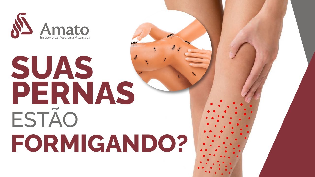 Formigamento nas Pernas: Causas e Possíveis Condições