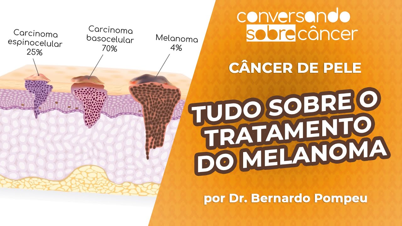 Guia Completo Do Melanoma Sintomas E Tratamentos Do C Ncer De Pele