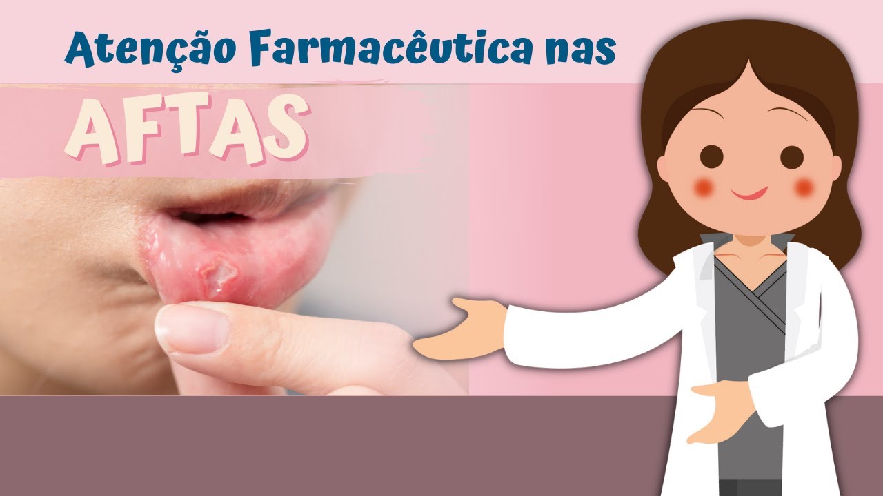 Tratamento de Aftas: Importância da Atenção Farmacêutica e Medicamentos ...