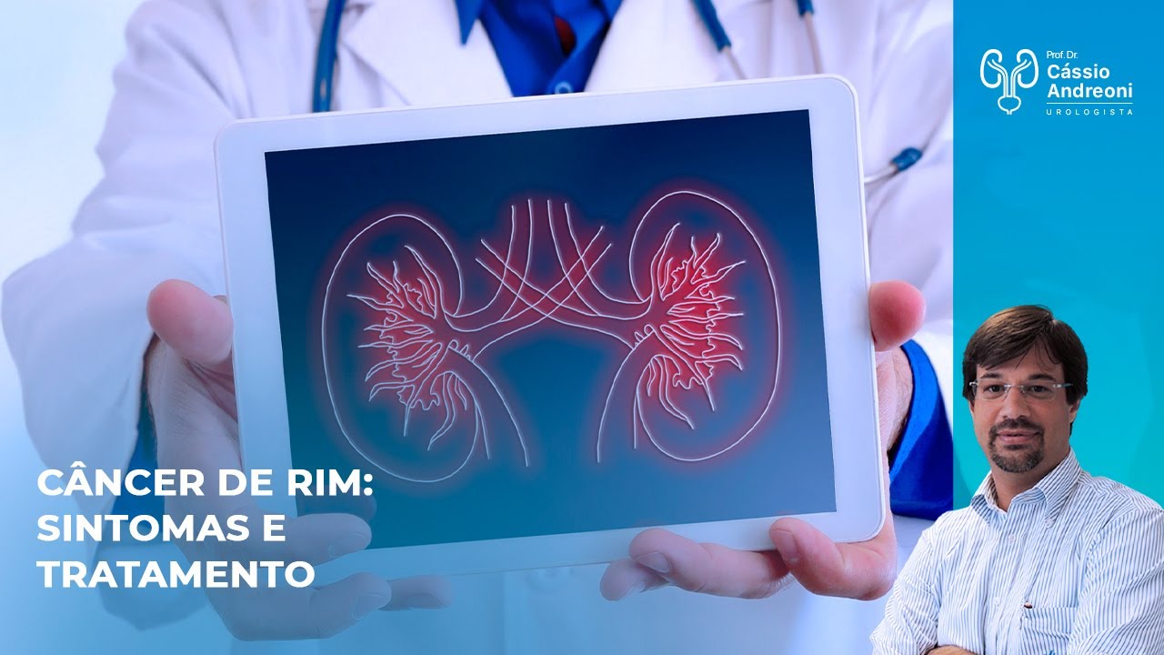 Tratamento e sintomas do câncer de rim com Dr. Cassio Andreoni CRM 78.546
