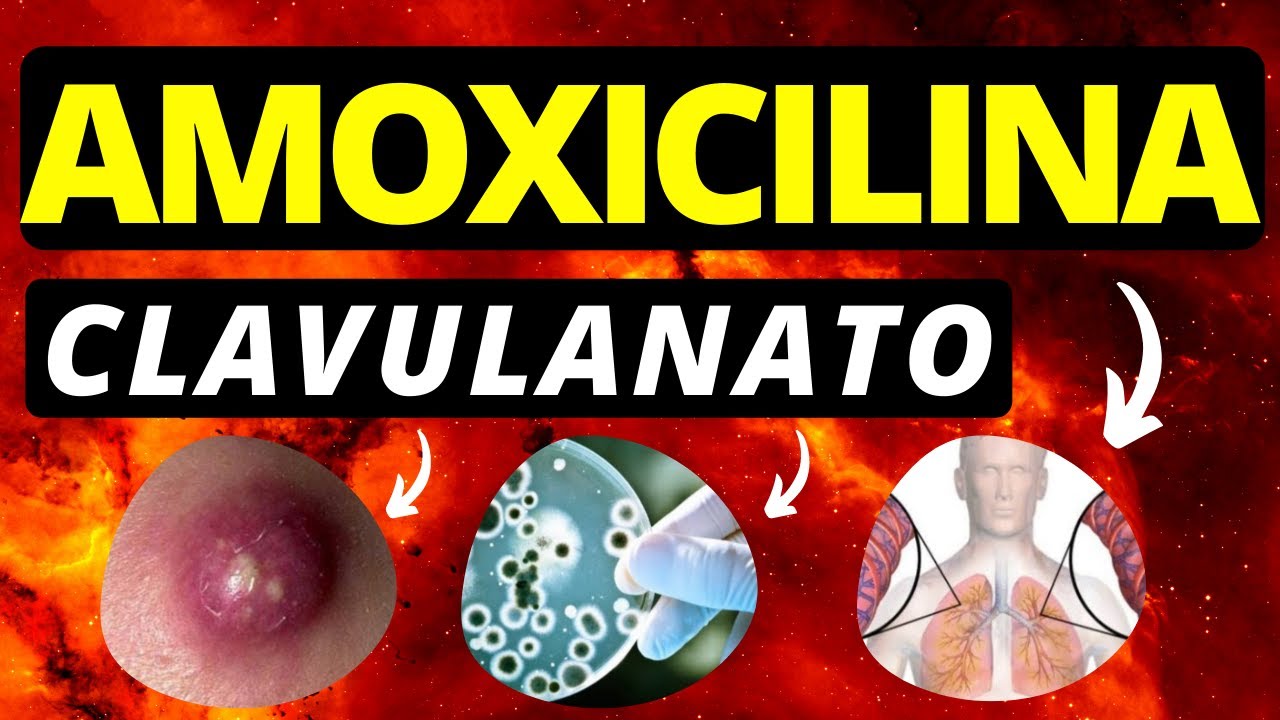 Amoxicilina Clavulanato: Apresentação, Indicação, Efeitos Colaterais e ...