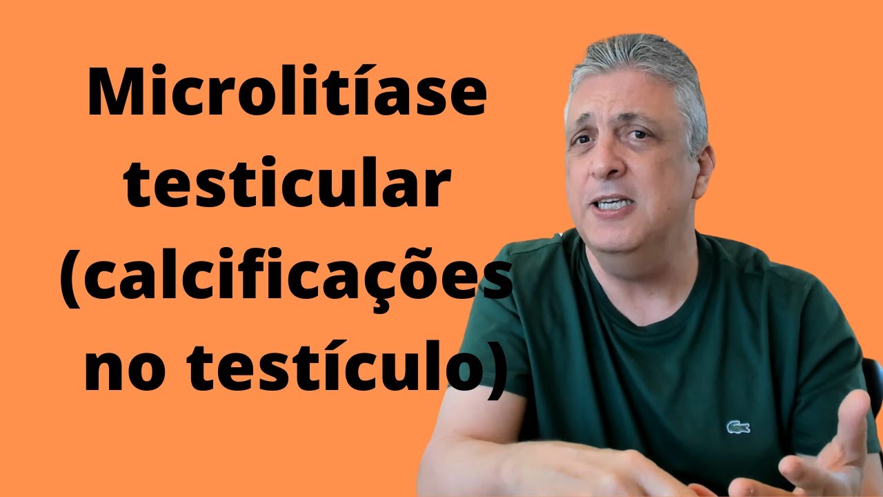 Calcificações no Testículo Causas e Tratamentos para Microlitíase