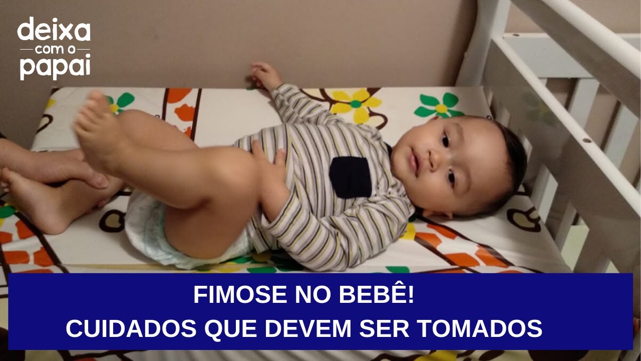 Fimose Em Beb S Cuidados Tipos E Dicas Para O Papai