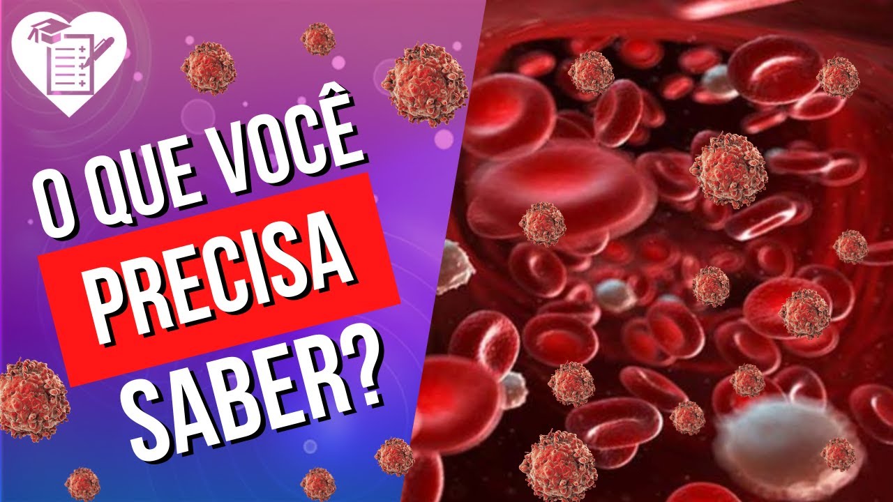 Leucemia: Causas, Sintomas E Tratamentos Disponíveis