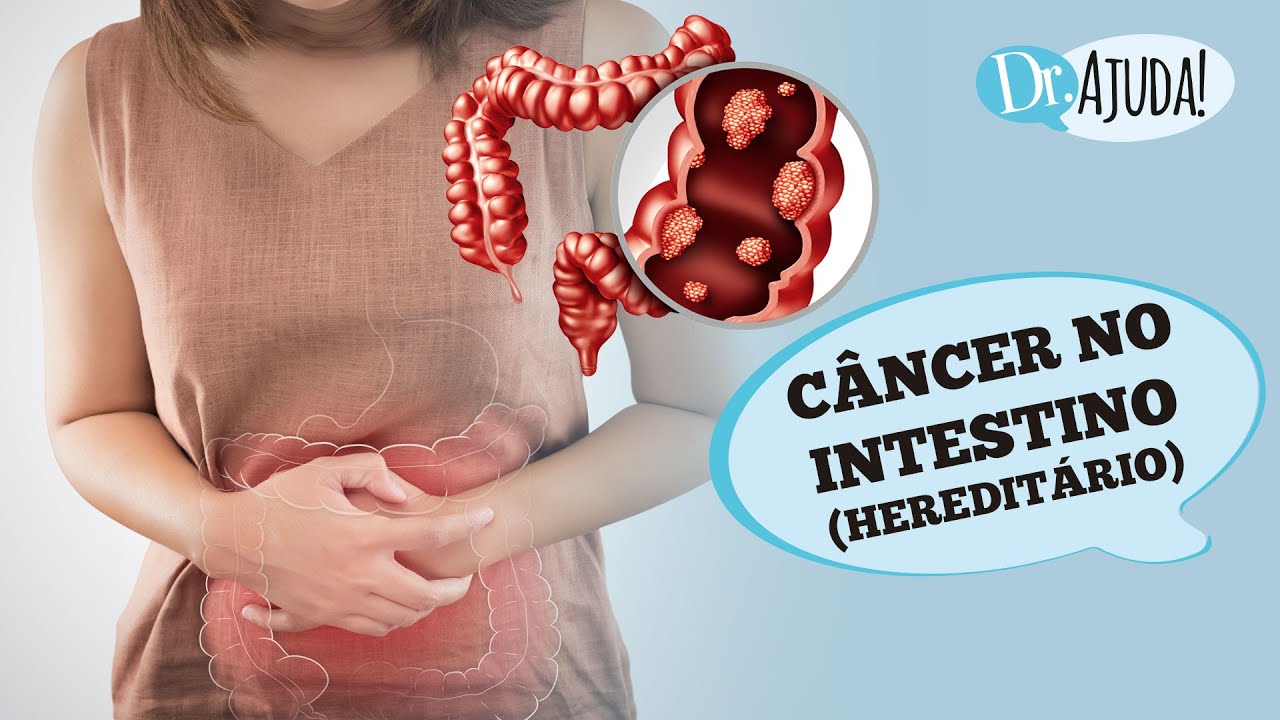 Câncer de Intestino Hereditário Preocupações e Sintomas. Câncer de Intestino Hereditário Preocupações e Sintomas.