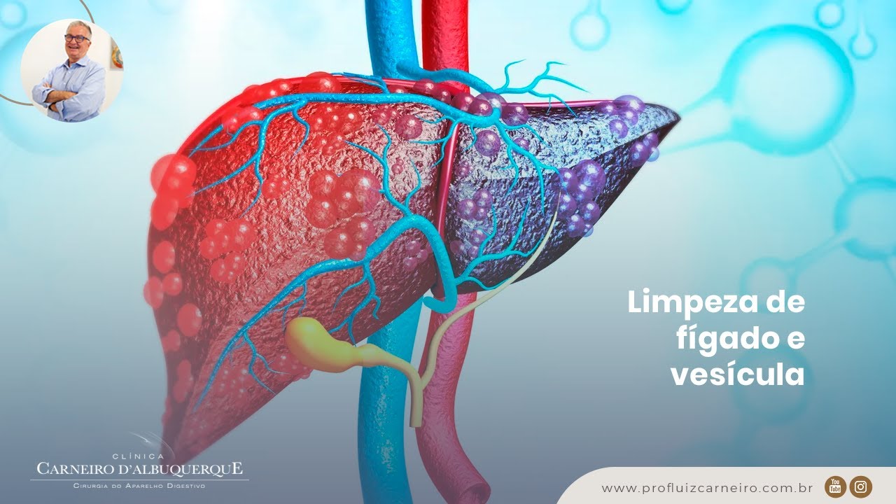 Limpeza de fígado e vesícula: Saiba mais com o Prof. Dr. Luiz Carneiro ...