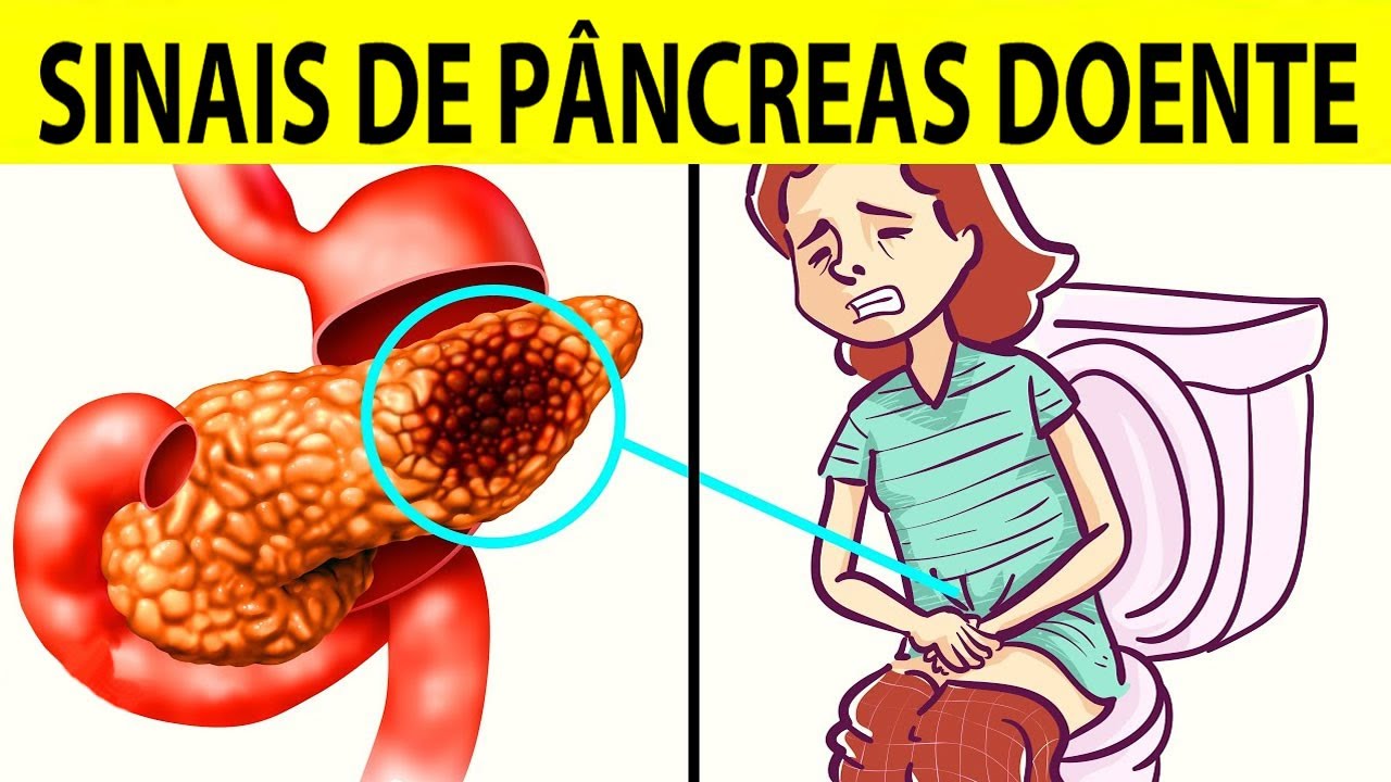 Sinais de pâncreas doente: conheça 7 sintomas comuns.