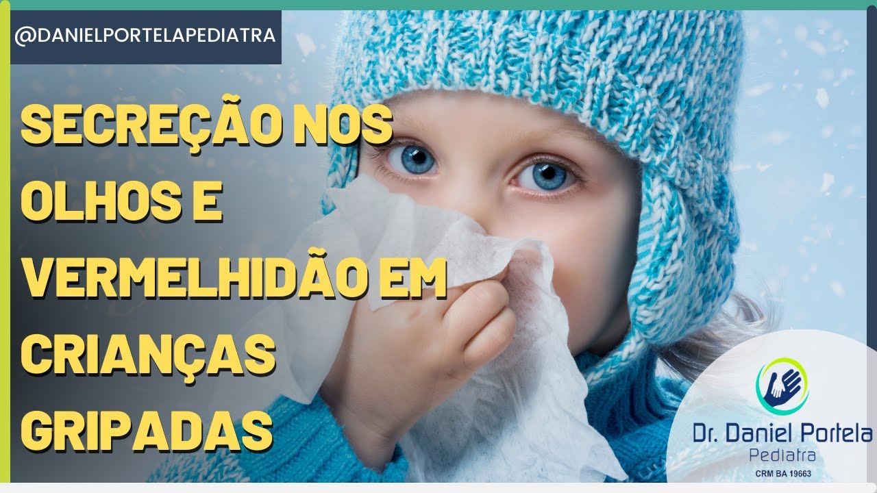 Tratando a secreção e vermelhidão nos olhos em crianças com gripe.