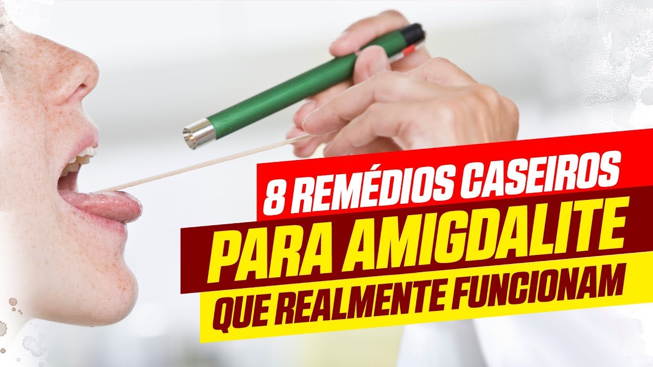 Amigdalite: 8 remédios caseiros eficazes