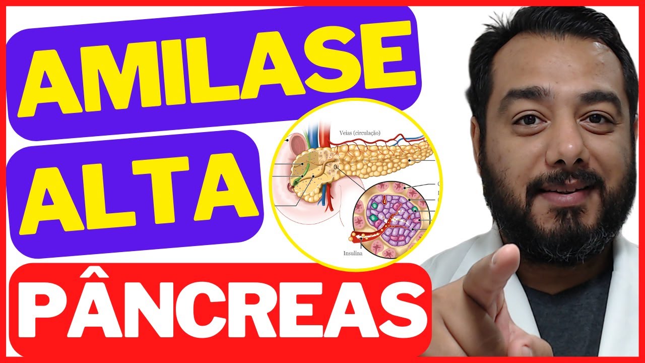 Causas da amilase alta no exame de sangue: pancreatite, caxumba ...
