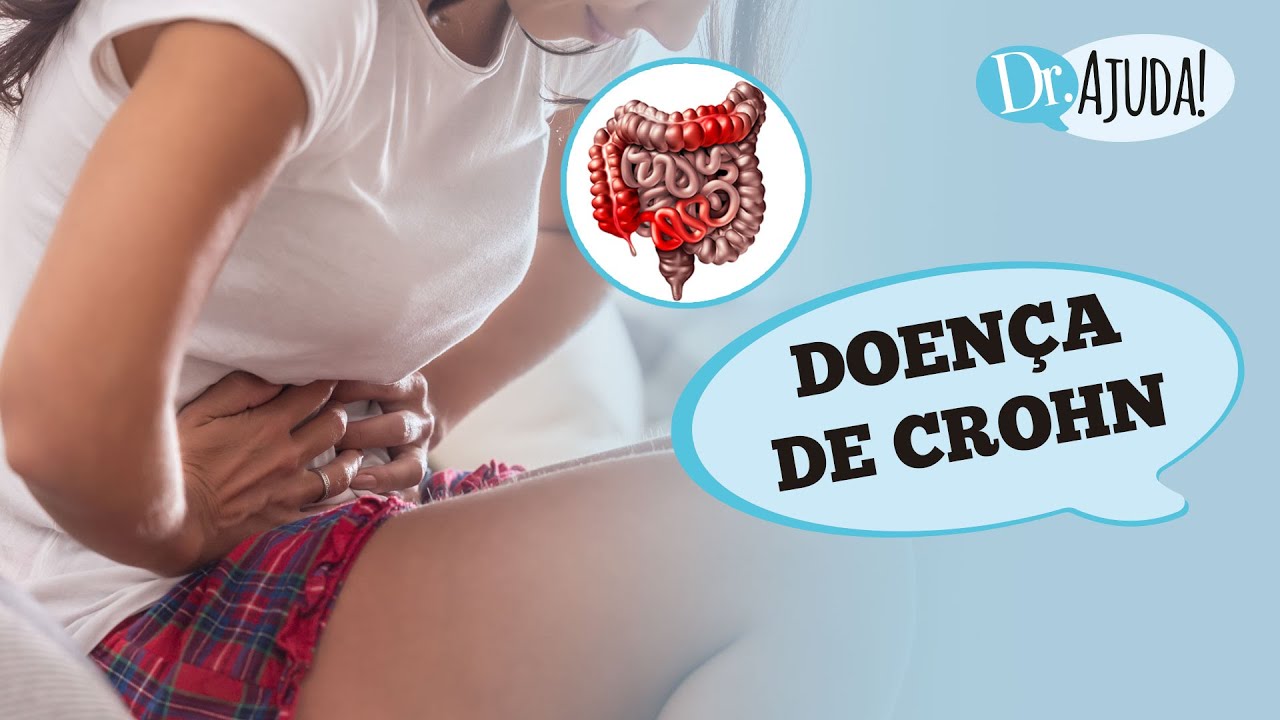 Doença De Crohn Causas Sintomas E Tratamento 