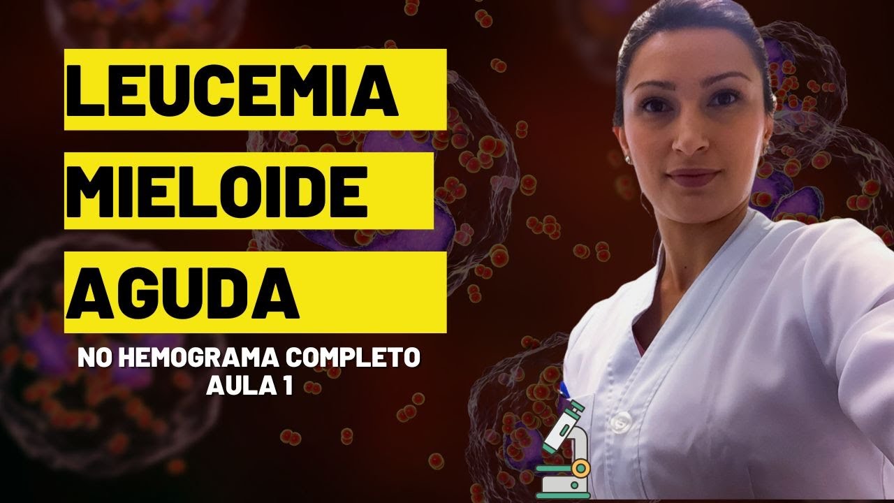 Identificando A Leucemia Mieloide Aguda No Hemograma Completo Dicas De Biomedicina E Hematologia