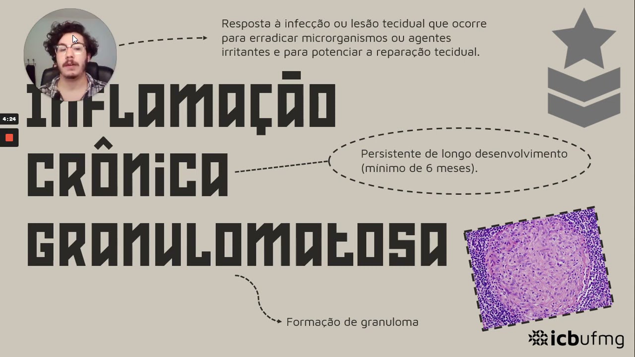 Inflamação Crônica Granulomatosa: Causas, Sintomas e Tratamento