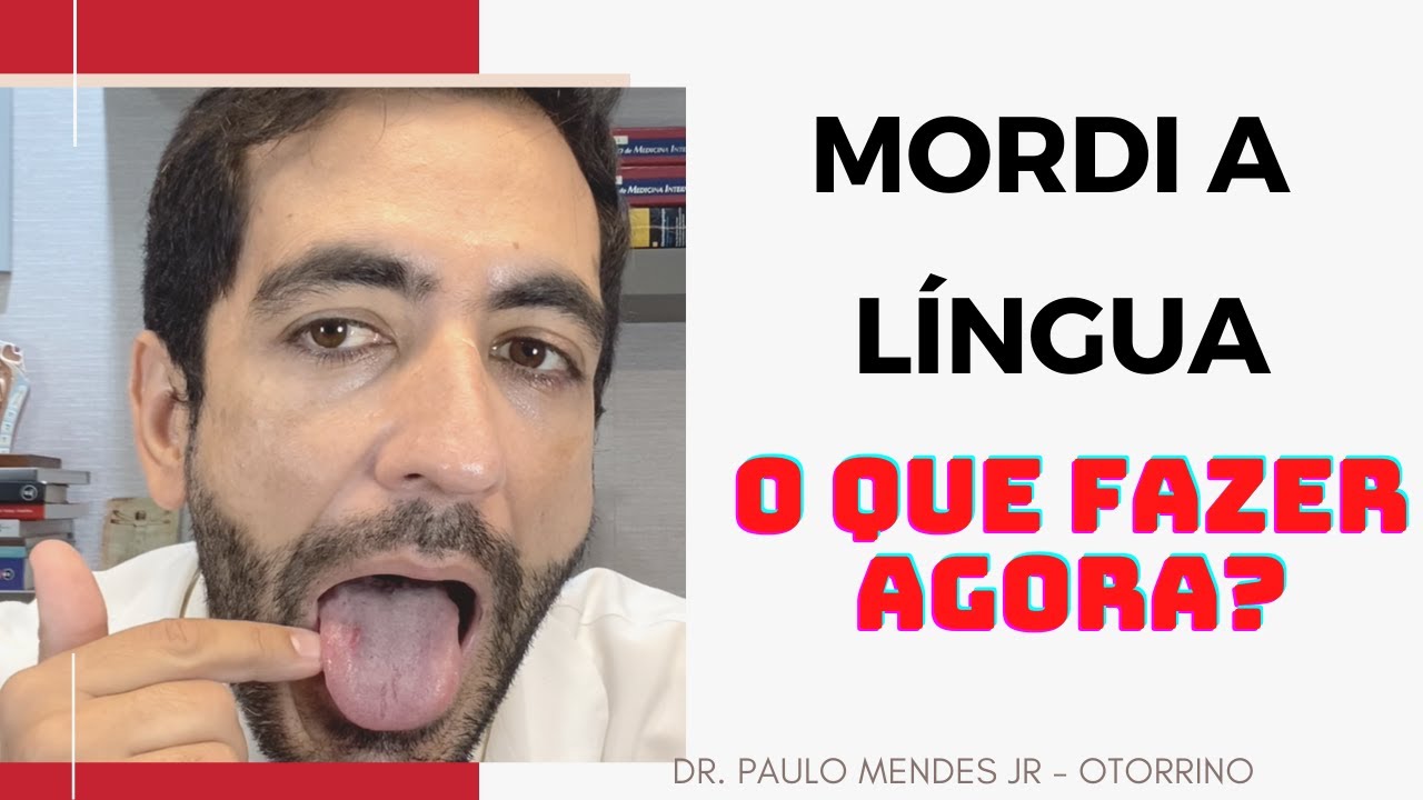 O que fazer após morder a língua: dicas e remédios caseiros para ...