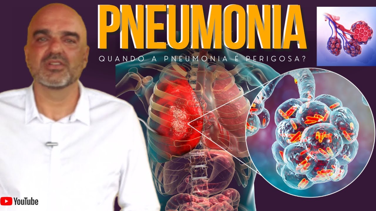 Pneumonia: Causas, Sintomas E Prevenção