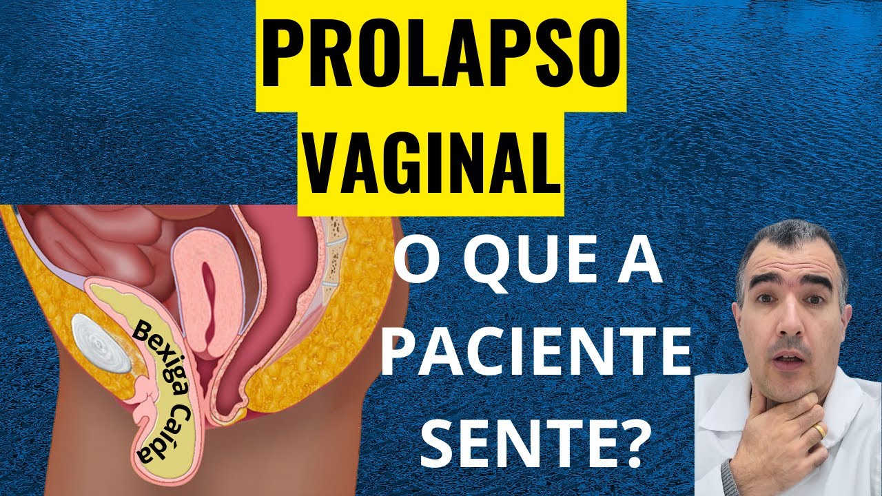 Sintomas E Percep O Do Prolapso Vaginal Entenda O Problema E Suas Indica Es