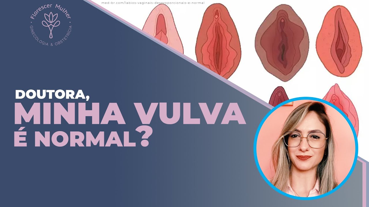 Vulva Conheça Os Sinais De Normalidade E Saiba Quando Procurar Um Médico 1425